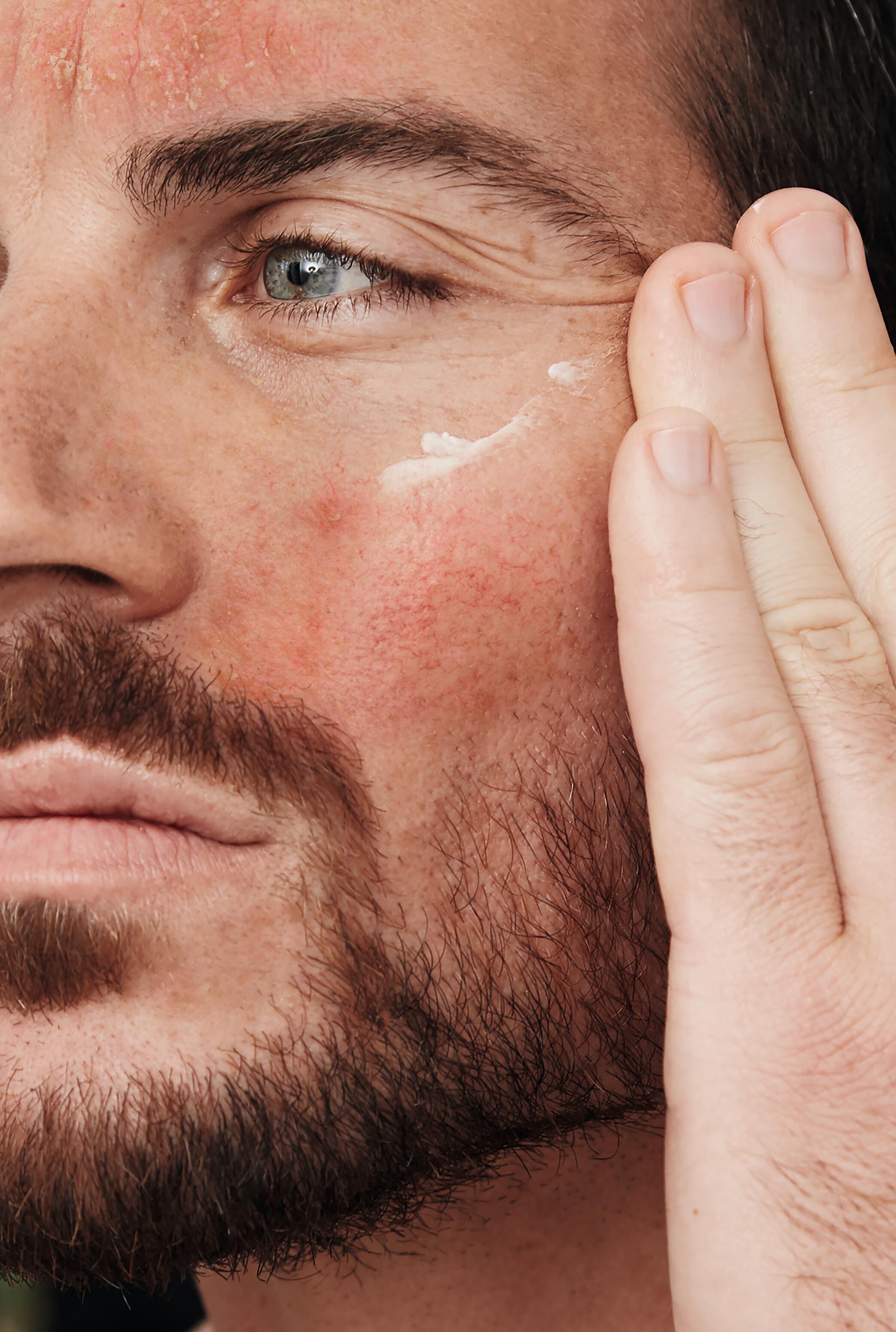 DU_KELUAL DS_CREAM_ANTI-SCALE CLEANSING GEL_PATHOLOGY-VISUAL_10-2023